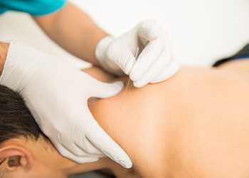 Wyndham Physio & Rehab Dry Needling Service